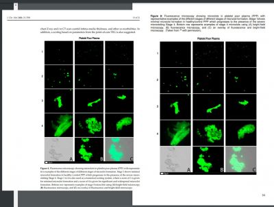 Microclot-paper-figure-comparison.jpg